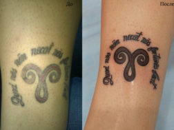 Исправление старой татуировки Cover-up