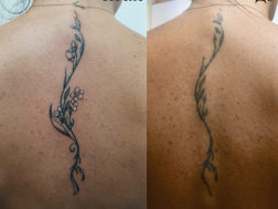 Исправление татуировки на спине (cover up)